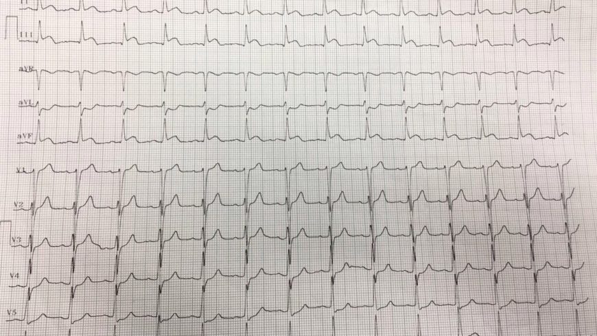 Desafio de ECG – Belém