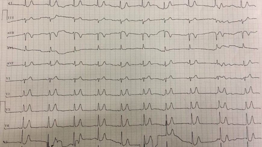 Desafio de ECG – Santo André